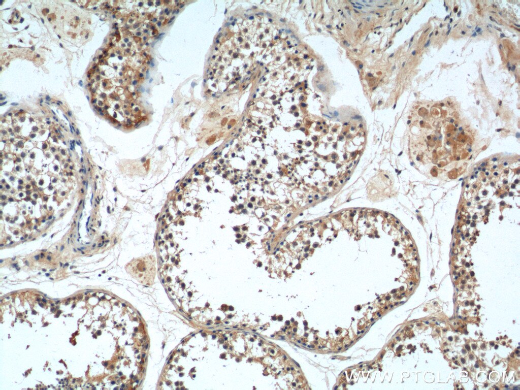 Immunohistochemistry (IHC) staining of human testis tissue using MAGEF1 Polyclonal antibody (24105-1-AP)