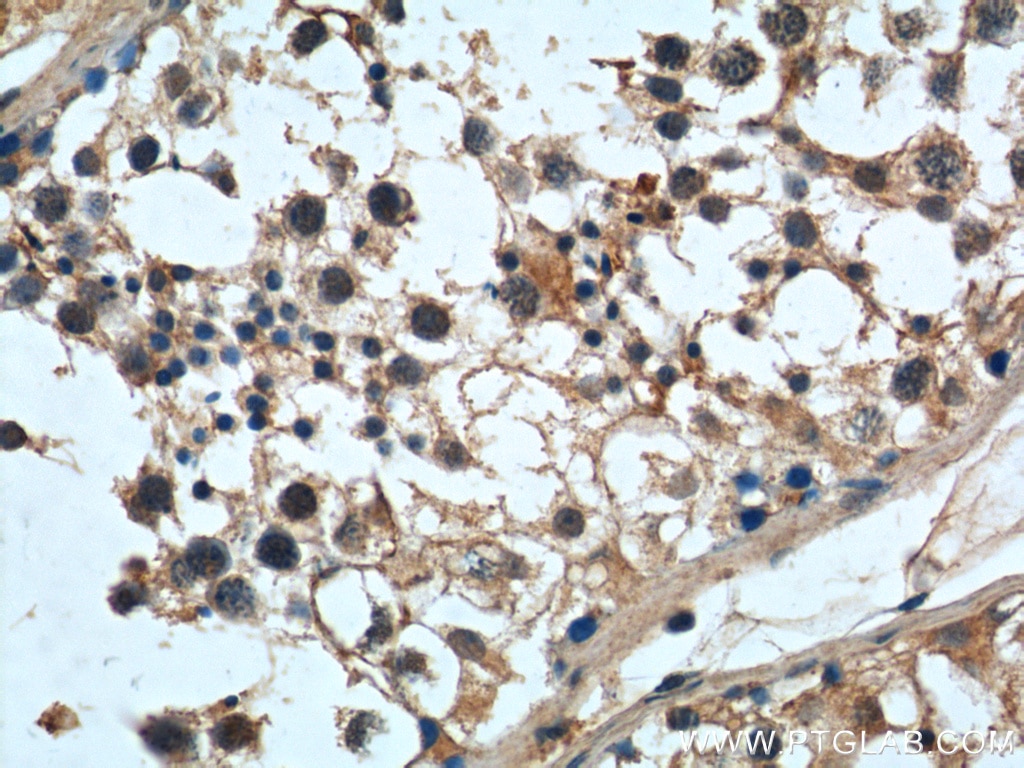 Immunohistochemistry (IHC) staining of human testis tissue using MAGEF1 Polyclonal antibody (24105-1-AP)