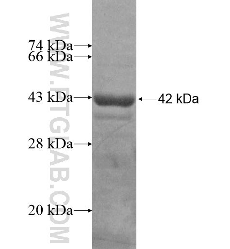 MAGEF1 fusion protein Ag13309 SDS-PAGE