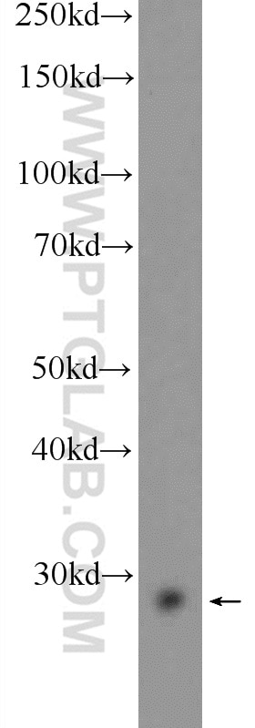 Western Blot (WB) analysis of PC-3 cells using MAGEH1 Polyclonal antibody (12424-1-AP)