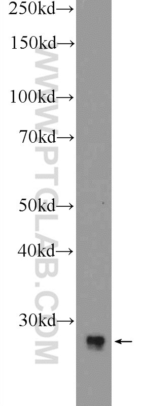 WB analysis of Y79 using 12424-1-AP