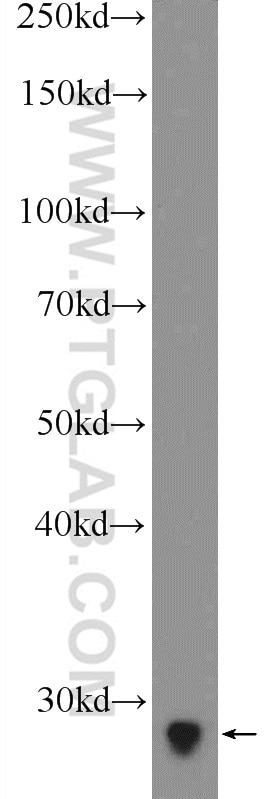 Western Blot (WB) analysis of mouse brain tissue using MAGEH1 Polyclonal antibody (12424-1-AP)