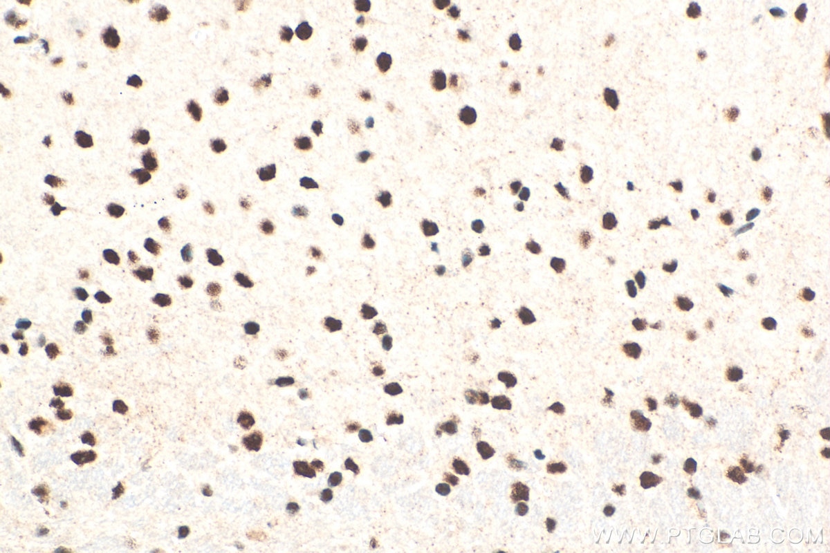 Immunohistochemistry (IHC) staining of mouse brain tissue using MAGEL2 Polyclonal antibody (33836-1-AP)