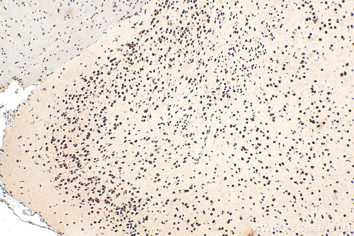 Immunohistochemistry (IHC) staining of mouse brain tissue using MAGEL2 Polyclonal antibody (33836-1-AP)