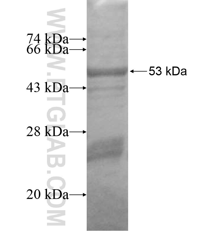 MAGEL2 fusion protein Ag16301 SDS-PAGE