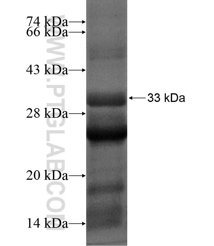 MAGEL2 fusion protein Ag17486 SDS-PAGE