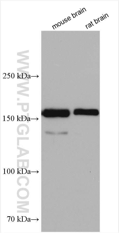 Western Blot (WB) analysis of various lysates using MAGI1 Polyclonal antibody (55048-1-AP)