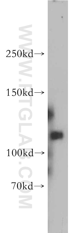 Western Blot (WB) analysis of human brain tissue using MAGI1 Polyclonal antibody (55048-1-AP)
