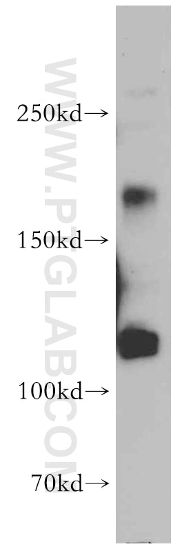 Western Blot (WB) analysis of mouse kidney tissue using MAGI1 Polyclonal antibody (55048-1-AP)