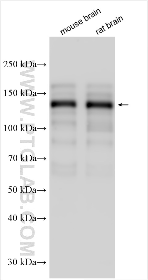 Western Blot (WB) analysis of various lysates using MAGI2 Polyclonal antibody (25189-1-AP)