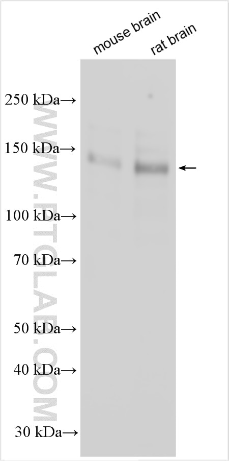 Western Blot (WB) analysis of various lysates using MAGI2 Polyclonal antibody (25189-1-AP)