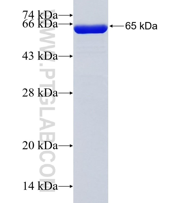 MAGI2 fusion protein Ag18279 SDS-PAGE