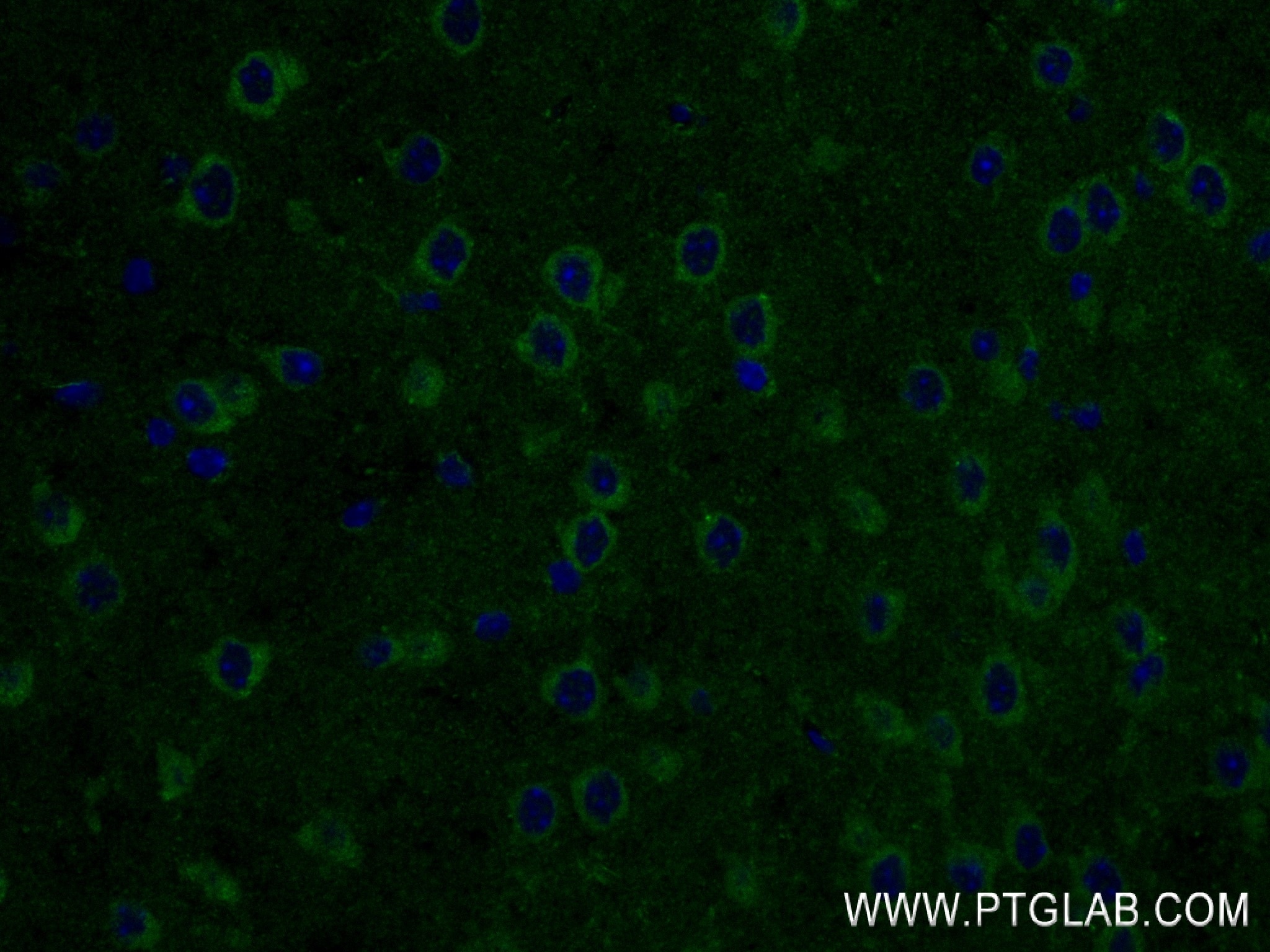 Immunofluorescence (IF) / fluorescent staining of mouse brain tissue using MAGI3 Recombinant antibody (84771-4-RR)