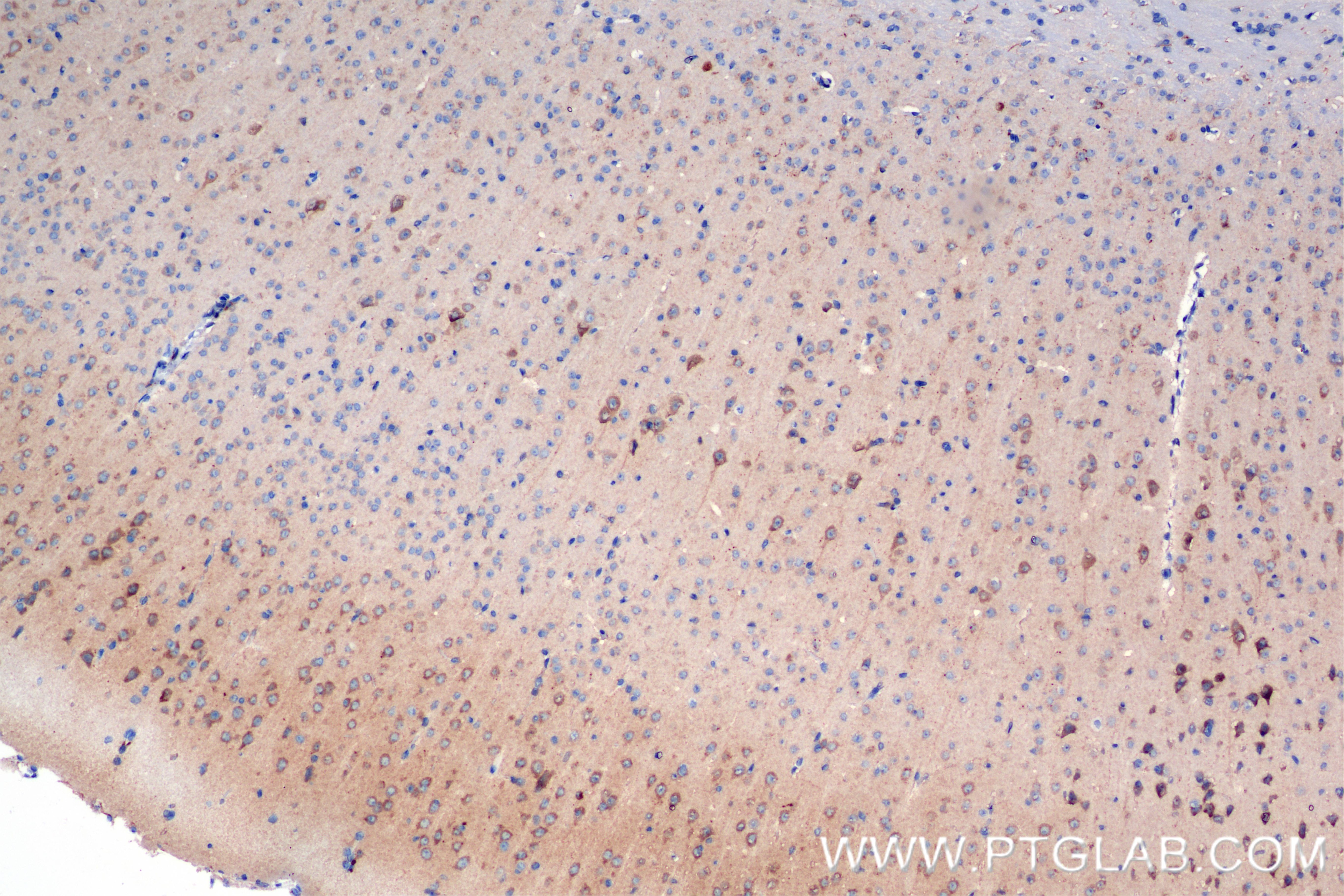 Immunohistochemistry (IHC) staining of mouse brain tissue using MAGI3 Recombinant antibody (84771-4-RR)