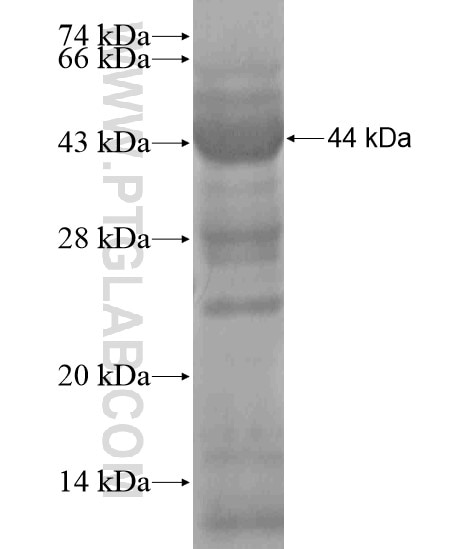 MAGI3 fusion protein Ag18593 SDS-PAGE