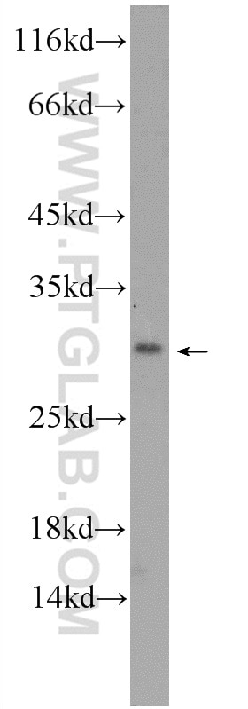 Western Blot (WB) analysis of mouse testis tissue using MAGIX Polyclonal antibody (24518-1-AP)