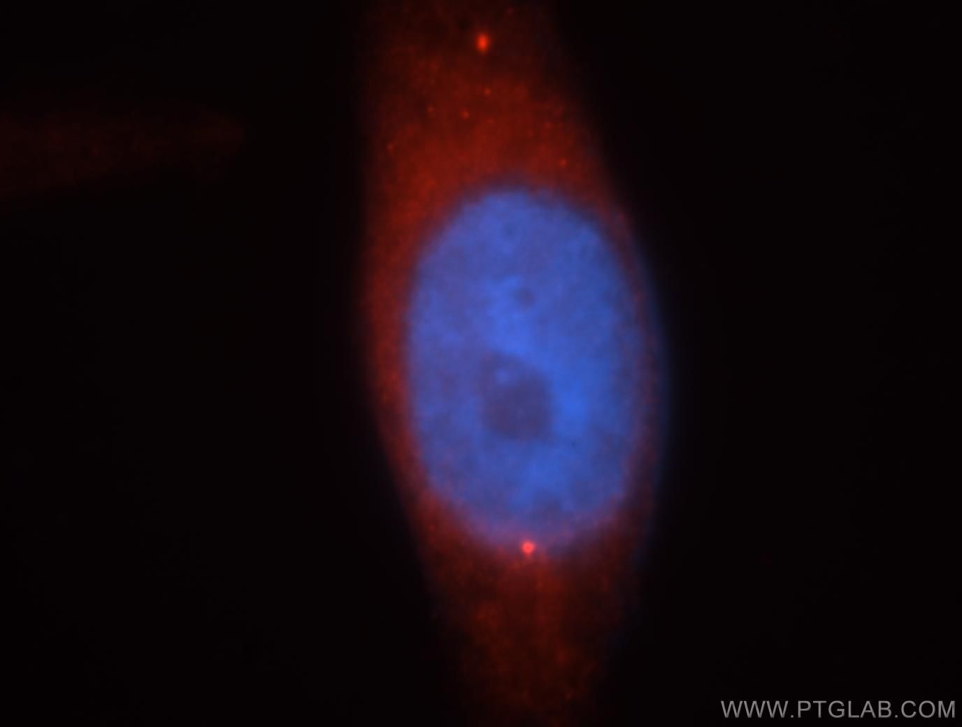 Immunofluorescence (IF) / fluorescent staining of HepG2 cells using MAGT1 Polyclonal antibody (17430-1-AP)