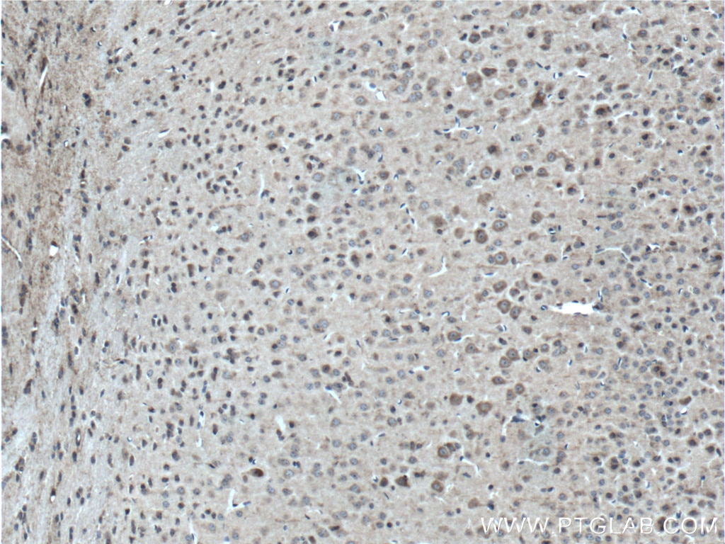 Immunohistochemistry (IHC) staining of mouse brain tissue using MAGT1 Polyclonal antibody (17430-1-AP)