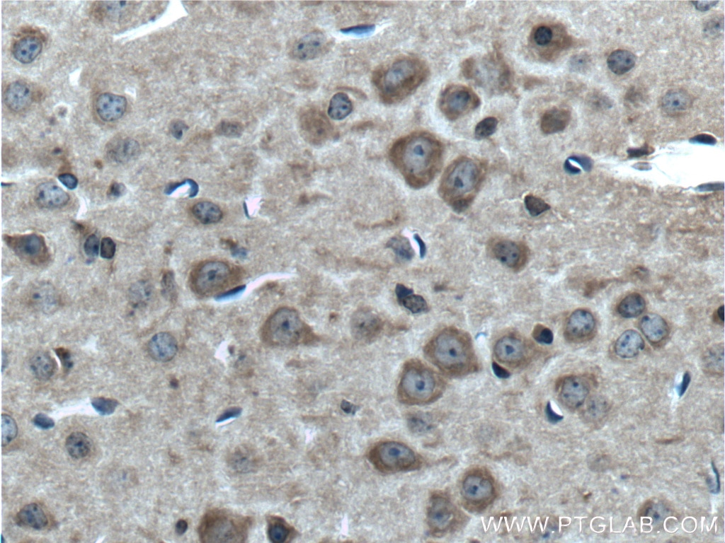 Immunohistochemistry (IHC) staining of mouse brain tissue using MAGT1 Polyclonal antibody (17430-1-AP)
