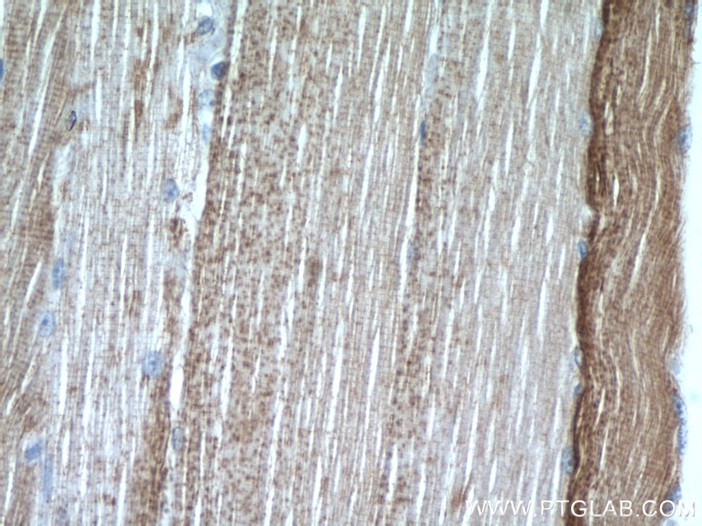 Immunohistochemistry (IHC) staining of human skeletal muscle tissue using MAGT1 Polyclonal antibody (17430-1-AP)