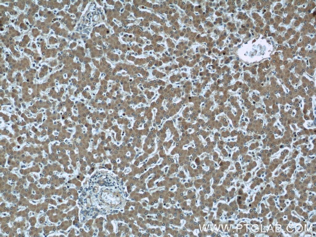Immunohistochemistry (IHC) staining of human liver tissue using MAGT1 Polyclonal antibody (17430-1-AP)