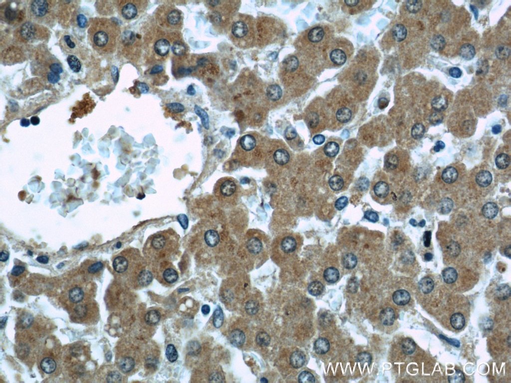 Immunohistochemistry (IHC) staining of human liver tissue using MAGT1 Polyclonal antibody (17430-1-AP)