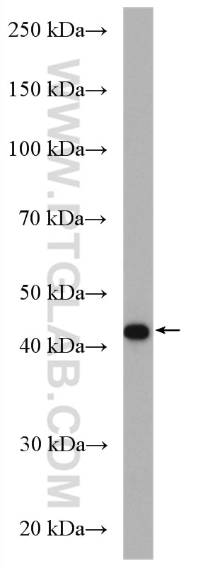 Western Blot (WB) analysis of COLO 320 cells using MAGT1 Polyclonal antibody (17430-1-AP)