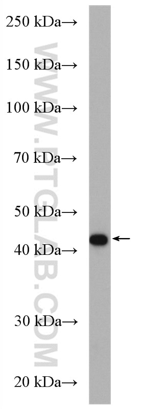 WB analysis of COLO 320 using 17430-1-AP