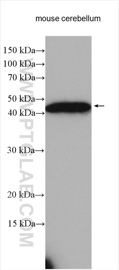 Western Blot (WB) analysis of various lysates using MAGT1 Polyclonal antibody (17430-1-AP)