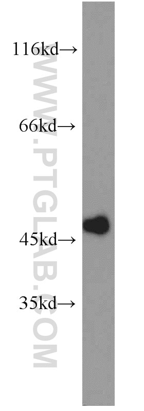 Western Blot (WB) analysis of mouse heart tissue using MAGT1 Polyclonal antibody (17430-1-AP)