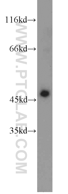 Western Blot (WB) analysis of mouse colon tissue using MAGT1 Polyclonal antibody (17430-1-AP)