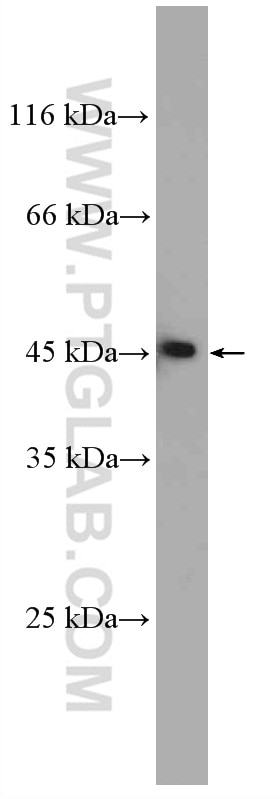 Western Blot (WB) analysis of HEK-293 cells using MAGT1 Polyclonal antibody (17430-1-AP)