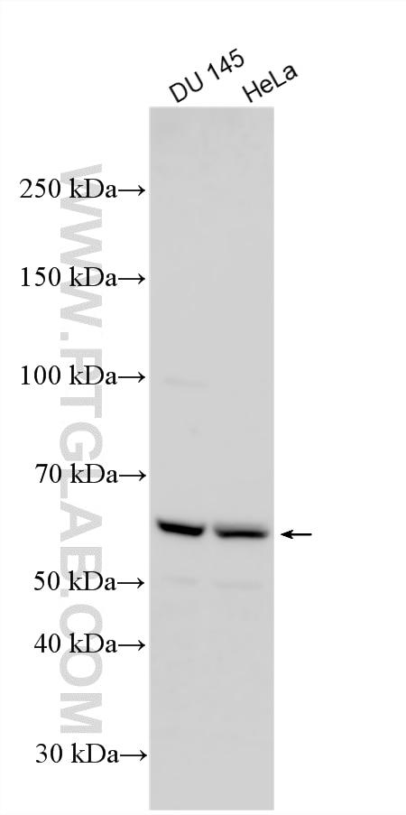 Various lysates were subjected to SDS PAGE followed by western blot with 13638-1-AP (MAK antibody) at dilution of 1:2000 incubated at room temperature for 1.5 hours. Western Blot (WB) analysis of various lysates using MAK Polyclonal antibody (13638-1-AP)