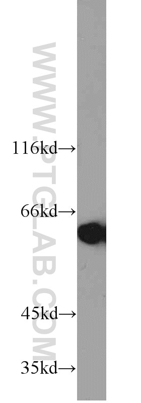 Western Blot (WB) analysis of HeLa cells using MAK Polyclonal antibody (13638-1-AP)
