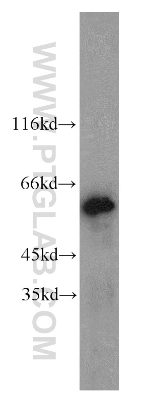 Western Blot (WB) analysis of PC-3 cells using MAK Polyclonal antibody (13638-1-AP)
