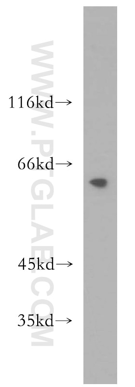 Western Blot (WB) analysis of PC-3 cells using MAK Polyclonal antibody (13638-1-AP)