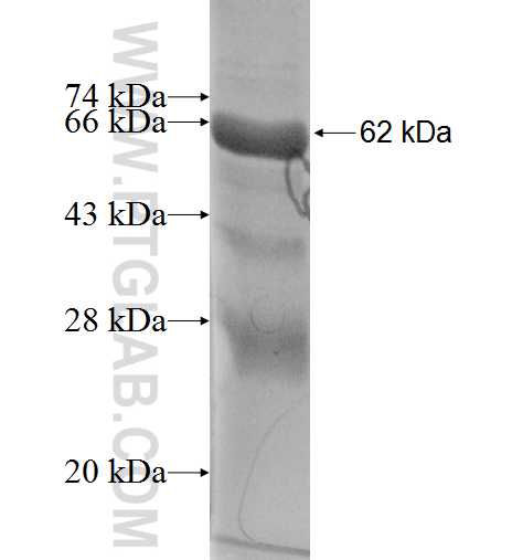 MAK fusion protein Ag4571 SDS-PAGE