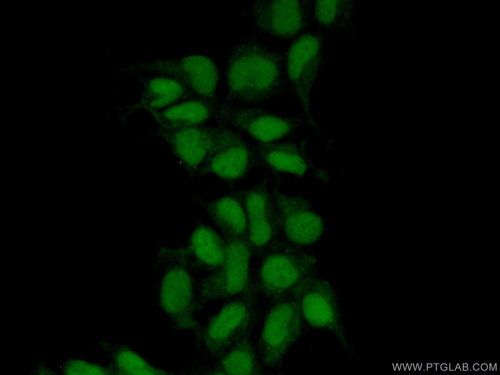 Immunofluorescence (IF) / fluorescent staining of HEK-293 cells using MAK16 Polyclonal antibody (17505-1-AP)