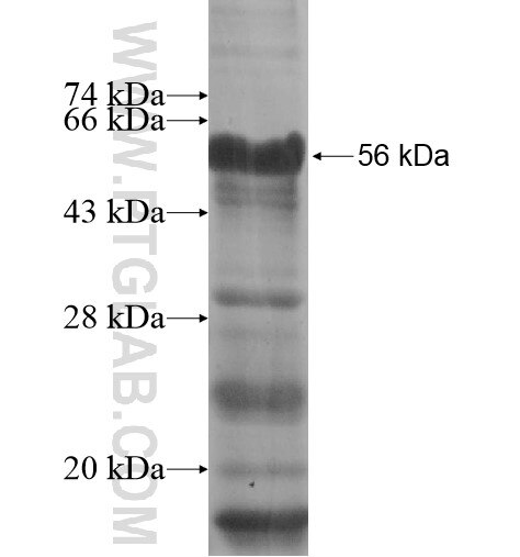 MAK16 fusion protein Ag11867 SDS-PAGE MAK16 fusion protein Ag11867 SDS-PAGE