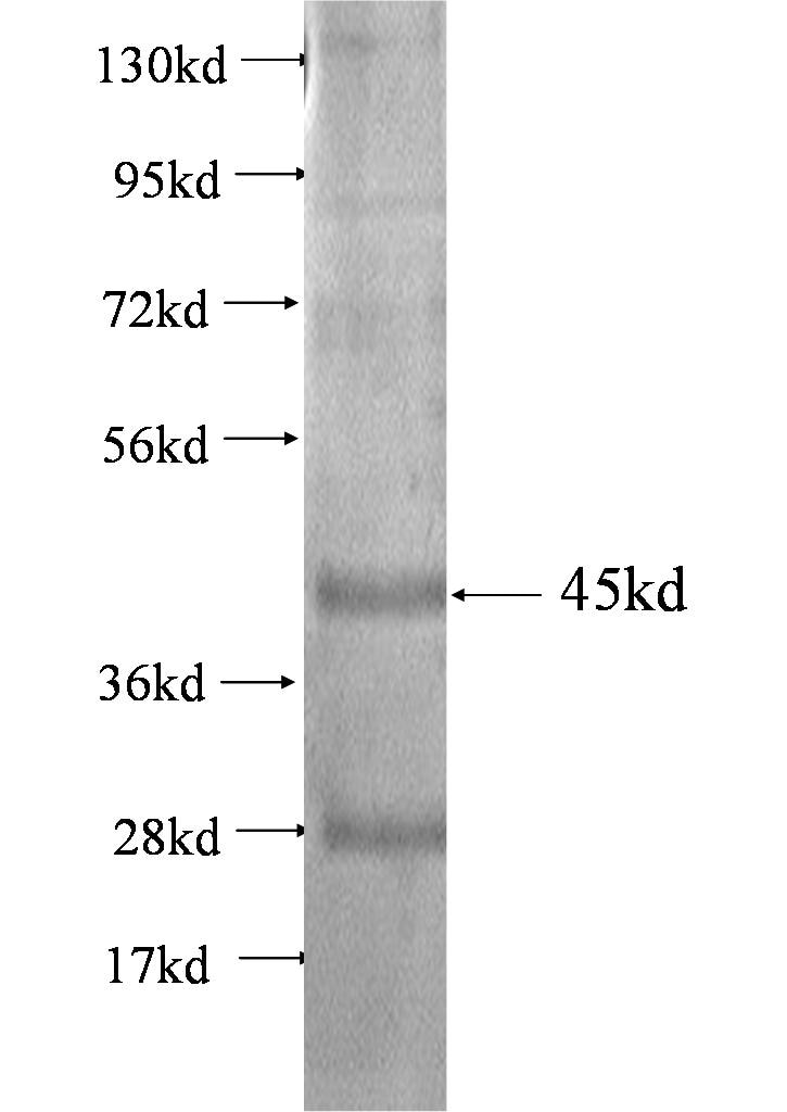 MAL2 fusion protein Ag1316 SDS-PAGE