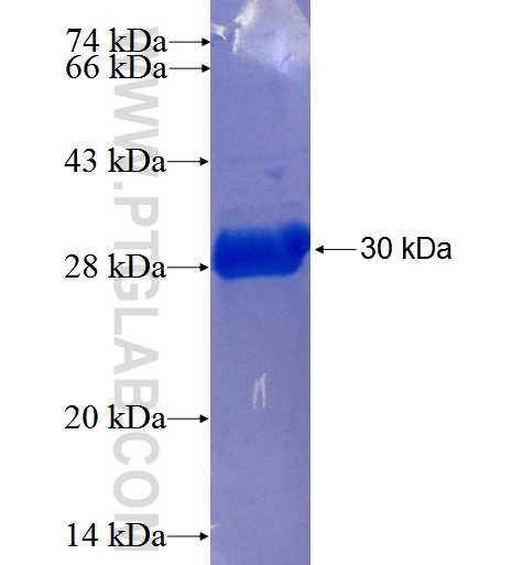 MALL fusion protein Ag25484 SDS-PAGE