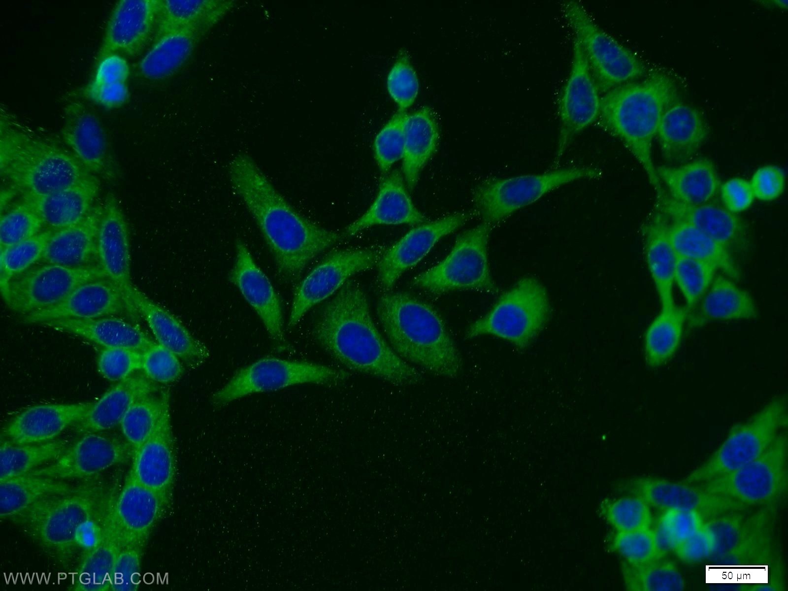 Immunofluorescence (IF) / fluorescent staining of HepG2 cells using MALT1 Polyclonal antibody (11660-1-AP)