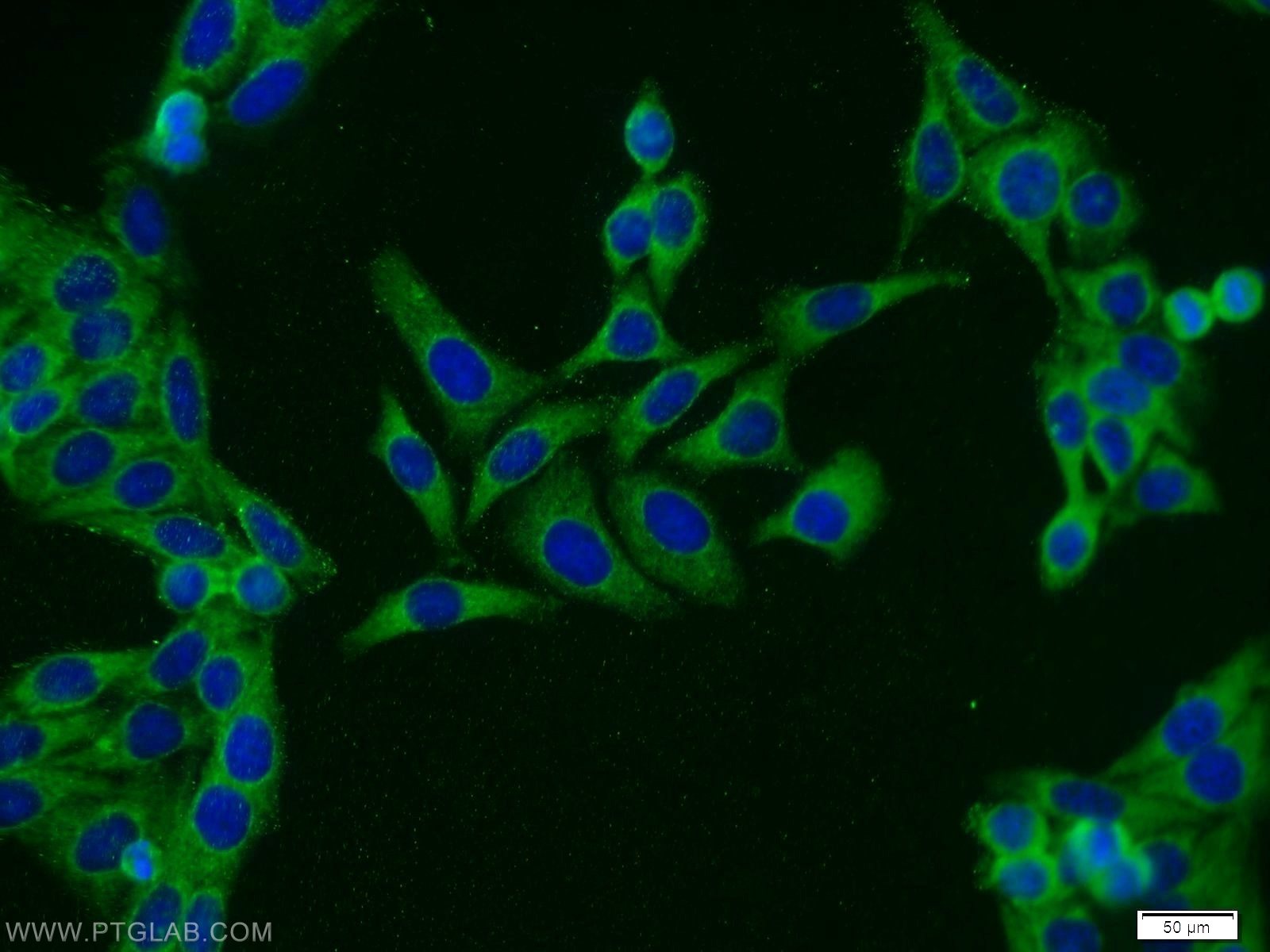 IF Staining of HepG2 using 11660-1-AP