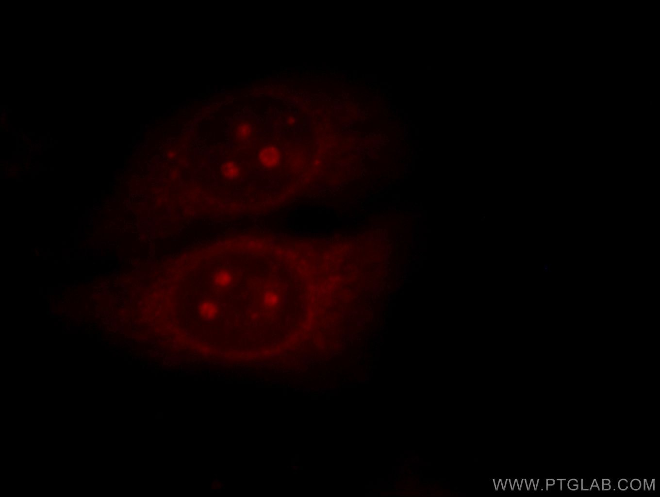 Immunofluorescence (IF) / fluorescent staining of HepG2 cells using MALT1 Polyclonal antibody (11660-1-AP)
