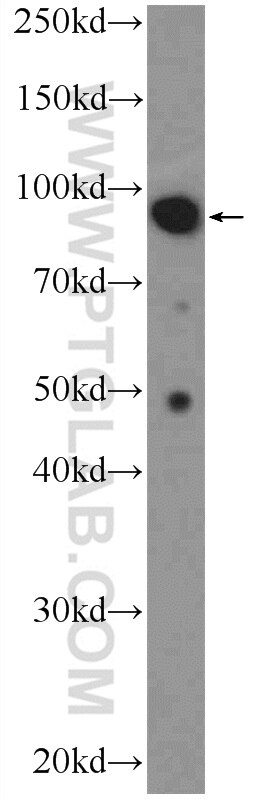 Western Blot (WB) analysis of mouse testis tissue using MALT1 Polyclonal antibody (11660-1-AP)