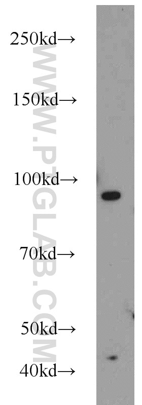 Western Blot (WB) analysis of HeLa cells using MALT1 Polyclonal antibody (11660-1-AP)
