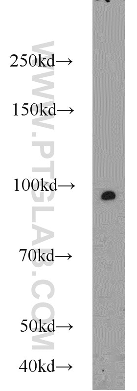 Western Blot (WB) analysis of mouse testis tissue using MALT1 Polyclonal antibody (11660-1-AP)