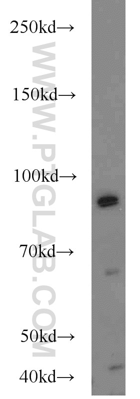 Western Blot (WB) analysis of HEK-293 cells using MALT1 Polyclonal antibody (11660-1-AP)