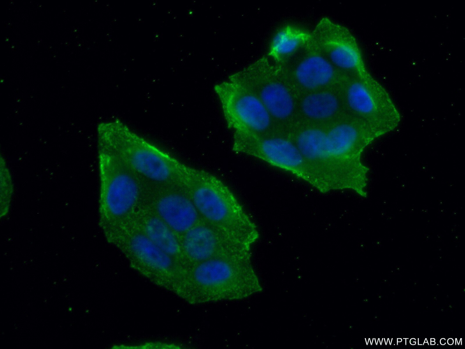 Immunofluorescence (IF) / fluorescent staining of HeLa cells using MALT1 Monoclonal antibody (66225-1-Ig)