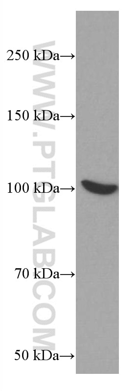 WB analysis of HeLa using 66225-1-Ig